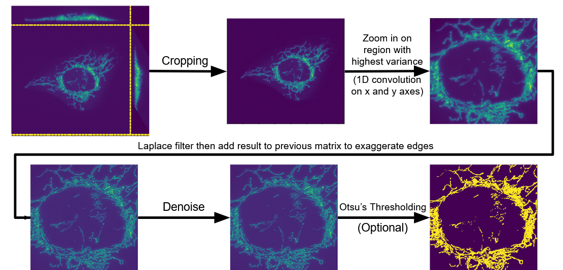 image of preprocessing pipeline